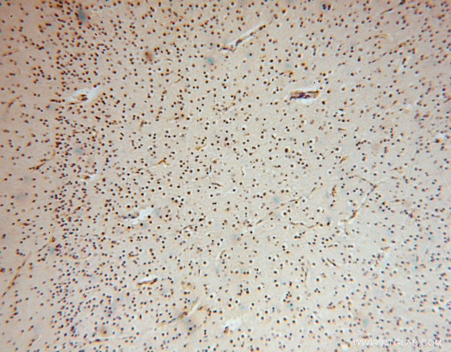 PYGL Antibody in Immunohistochemistry (Paraffin) (IHC (P))