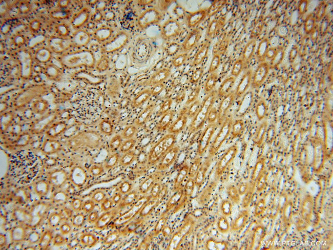 PYGL Antibody in Immunohistochemistry (Paraffin) (IHC (P))