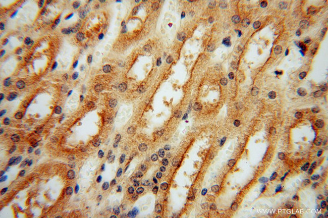 PYGL Antibody in Immunohistochemistry (Paraffin) (IHC (P))