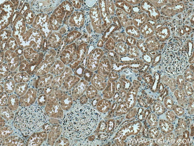 PYGL Antibody in Immunohistochemistry (Paraffin) (IHC (P))