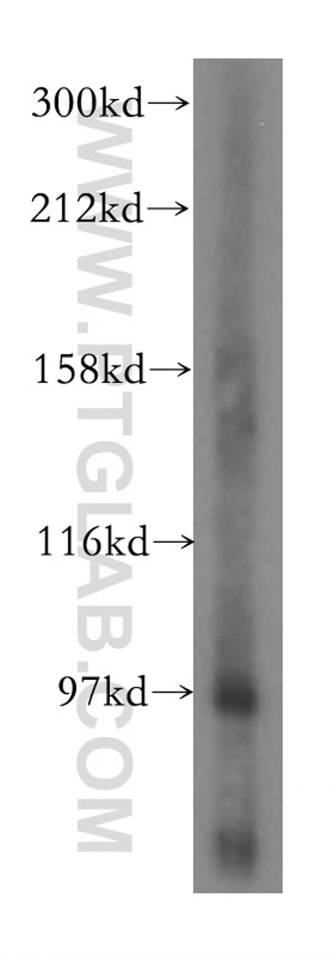 PYGL Antibody in Western Blot (WB)