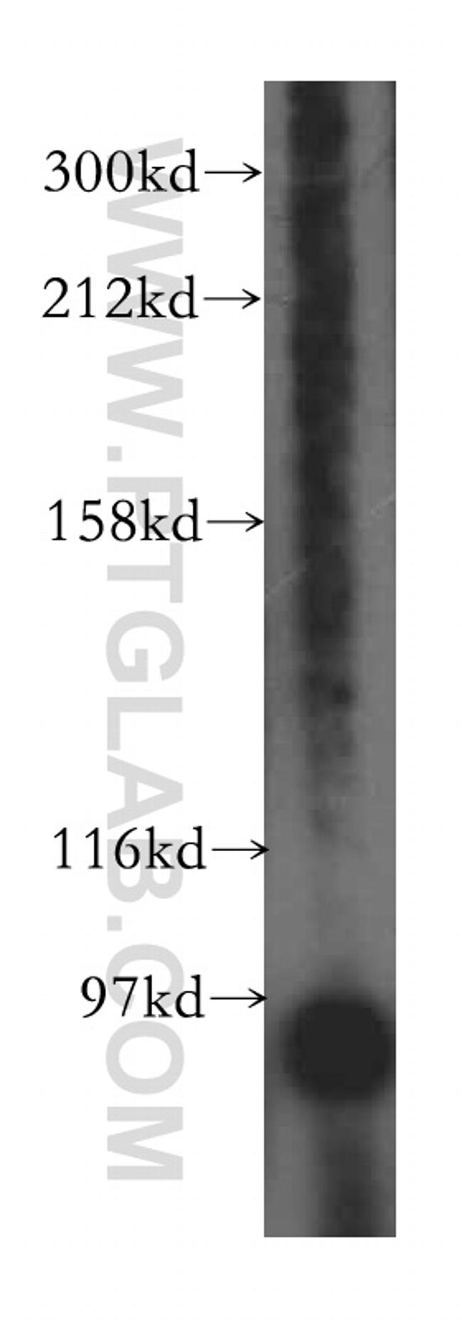 PYGL Antibody in Western Blot (WB)