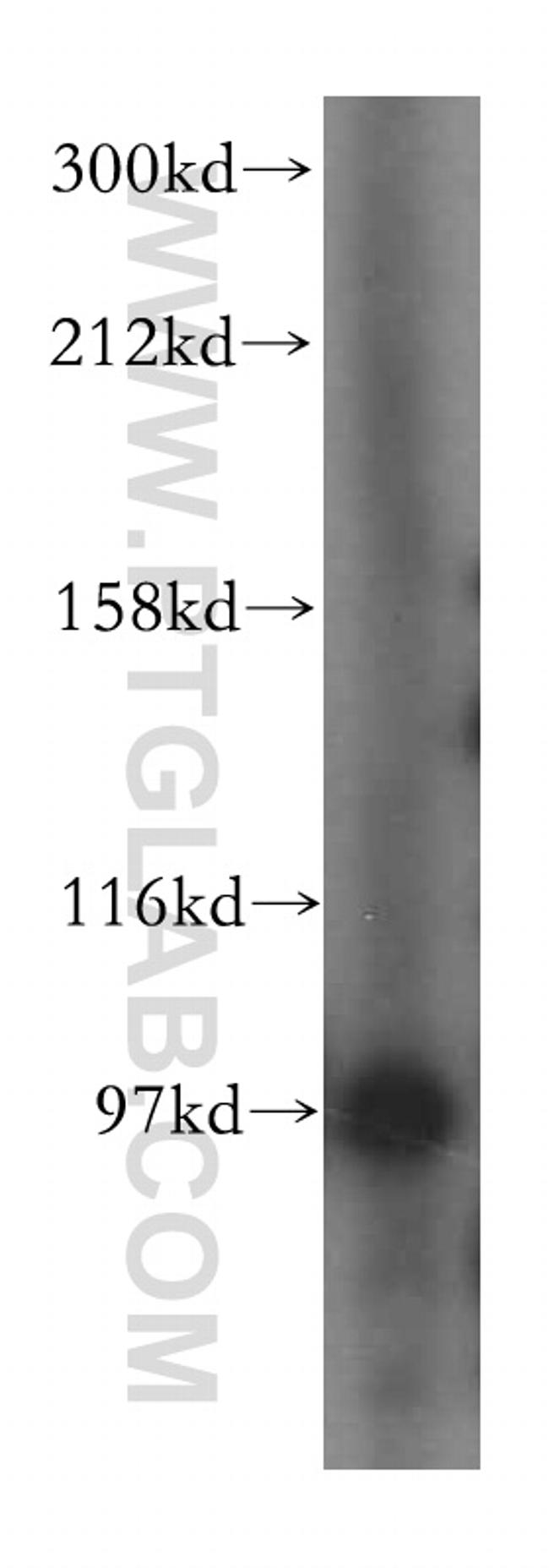 PYGL Antibody in Western Blot (WB)