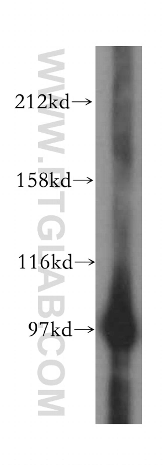 PYGL Antibody in Western Blot (WB)