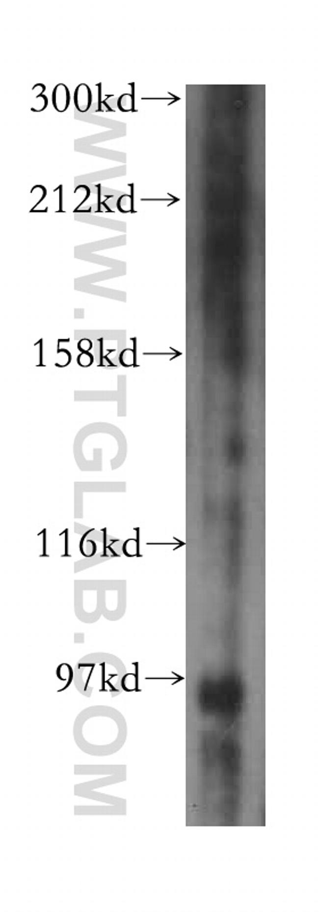 PYGL Antibody in Western Blot (WB)