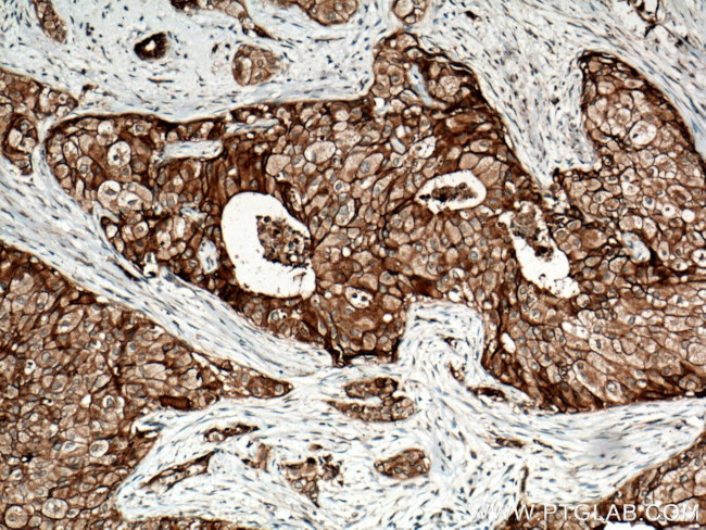 FXYD3 Antibody in Immunohistochemistry (Paraffin) (IHC (P))