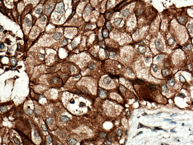 FXYD3 Antibody in Immunohistochemistry (Paraffin) (IHC (P))