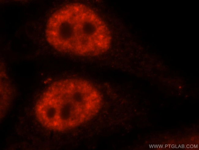 SF3A1 Antibody in Immunocytochemistry (ICC/IF)