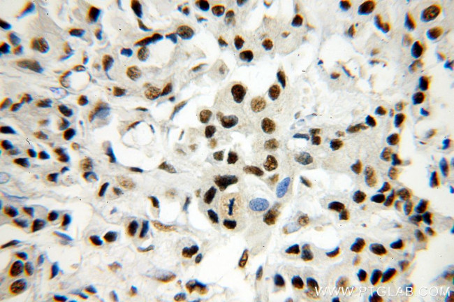 SF3A1 Antibody in Immunohistochemistry (Paraffin) (IHC (P))