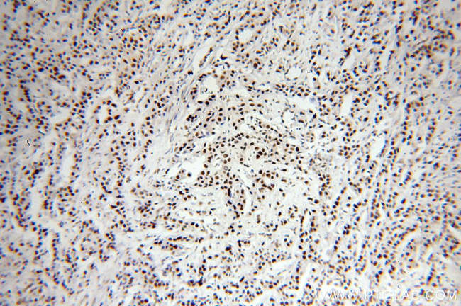 SF3A1 Antibody in Immunohistochemistry (Paraffin) (IHC (P))