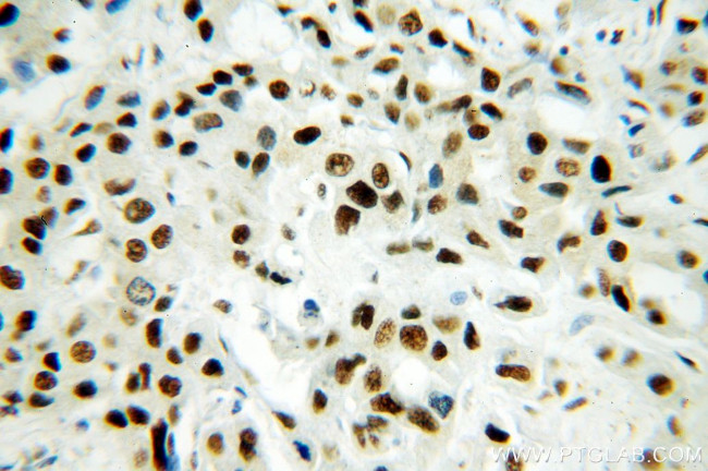 SF3A1 Antibody in Immunohistochemistry (Paraffin) (IHC (P))