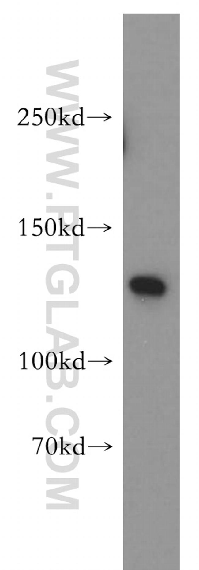 SF3A1 Antibody in Western Blot (WB)