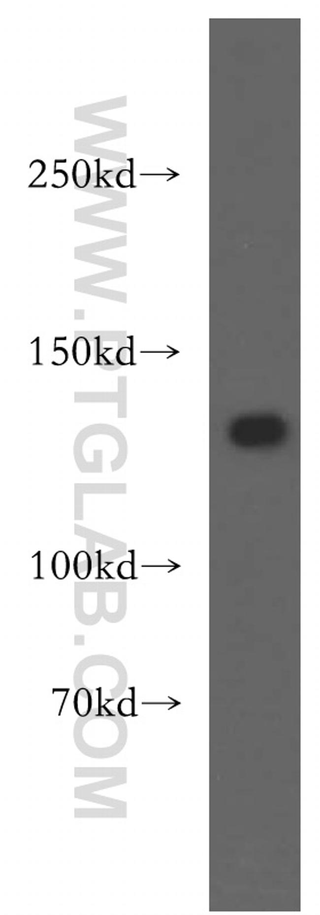 SF3A1 Antibody in Western Blot (WB)