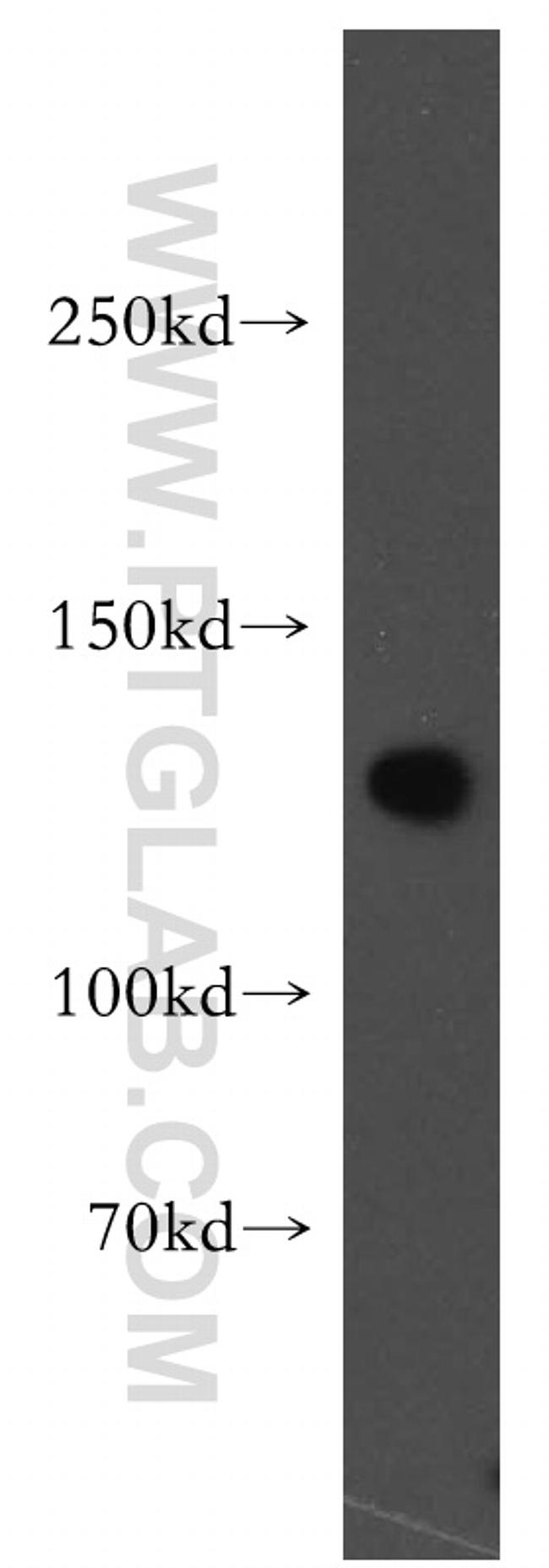 SF3A1 Antibody in Western Blot (WB)