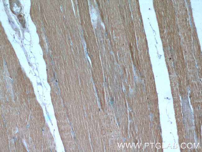 CAP2 Antibody in Immunohistochemistry (Paraffin) (IHC (P))