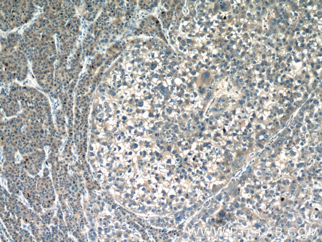 CAP2 Antibody in Immunohistochemistry (Paraffin) (IHC (P))