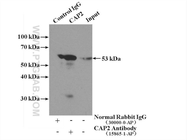 CAP2 Antibody in Immunoprecipitation (IP)