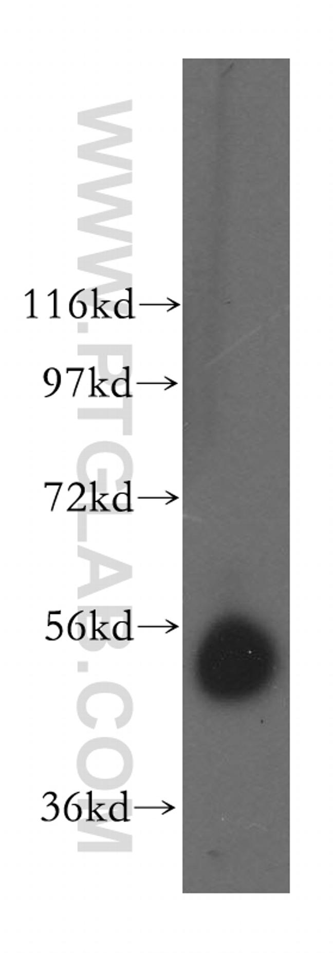 CAP2 Antibody in Western Blot (WB)