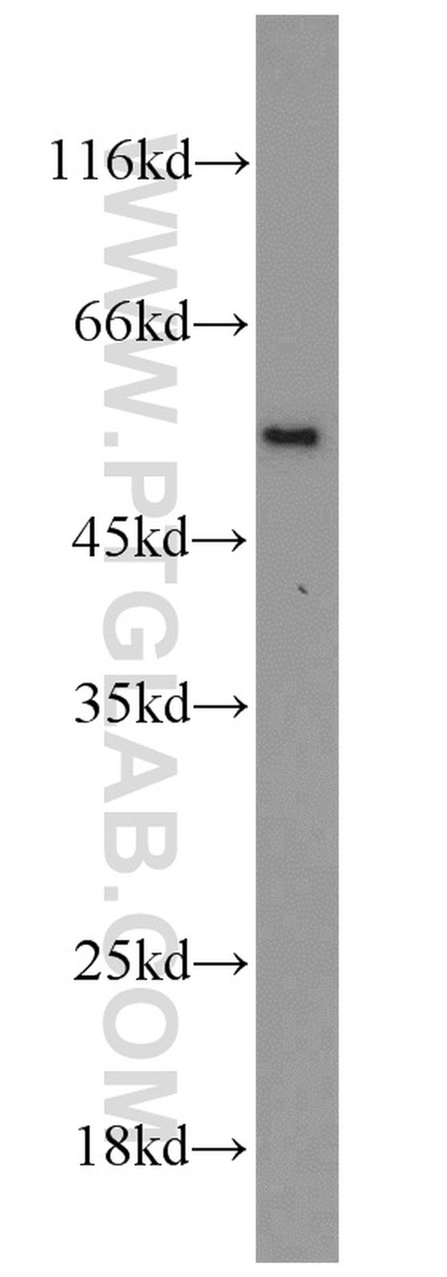 CAP2 Antibody in Western Blot (WB)