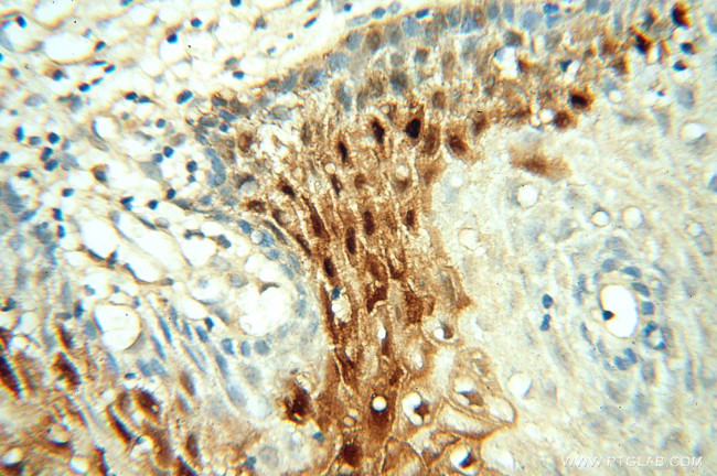 FABP4 Antibody in Immunohistochemistry (Paraffin) (IHC (P))