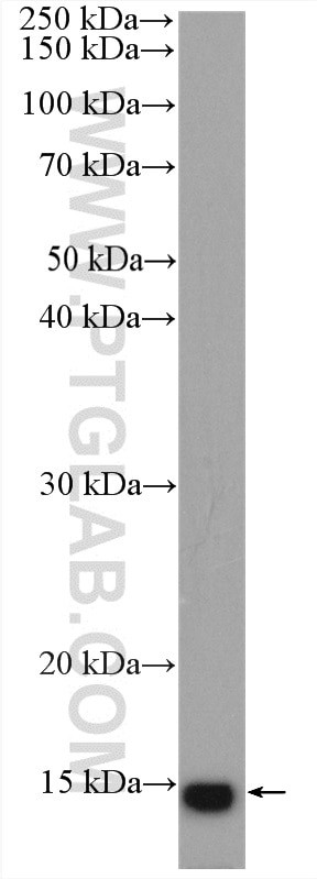 FABP4 Antibody in Western Blot (WB)