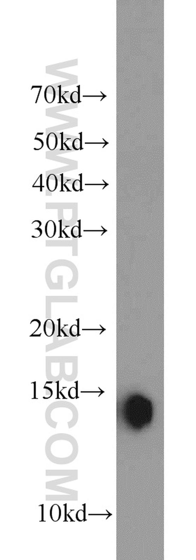 FABP4 Antibody in Western Blot (WB)