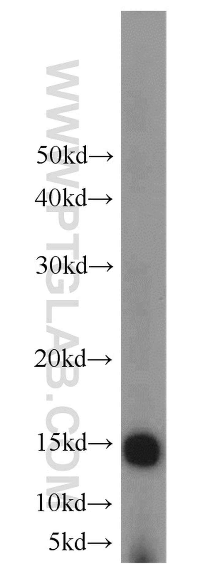 FABP4 Antibody in Western Blot (WB)