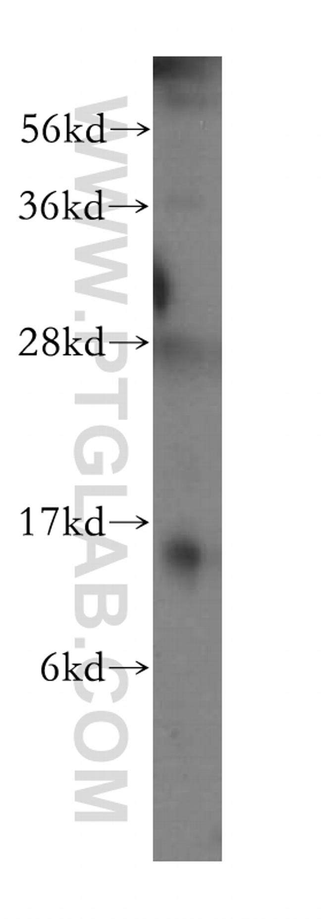 FABP4 Antibody in Western Blot (WB)