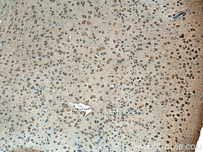 Centrin 2 Antibody in Immunohistochemistry (Paraffin) (IHC (P))