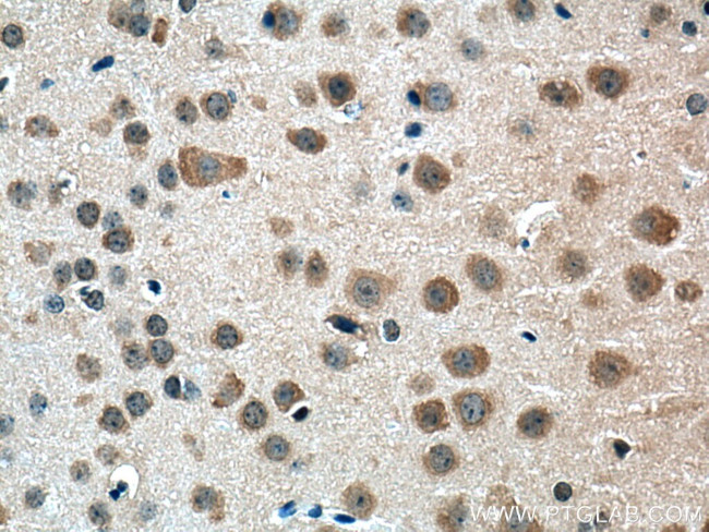 Centrin 2 Antibody in Immunohistochemistry (Paraffin) (IHC (P))