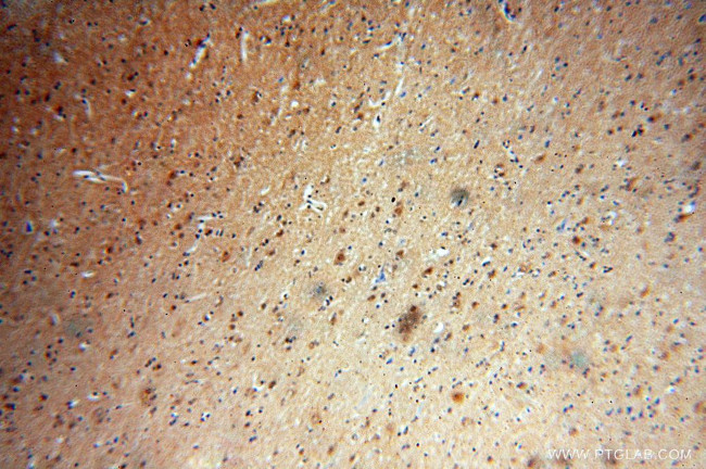 Centrin 2 Antibody in Immunohistochemistry (Paraffin) (IHC (P))