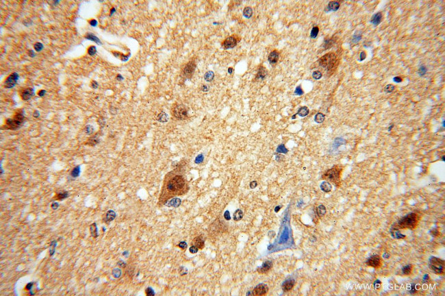 Centrin 2 Antibody in Immunohistochemistry (Paraffin) (IHC (P))