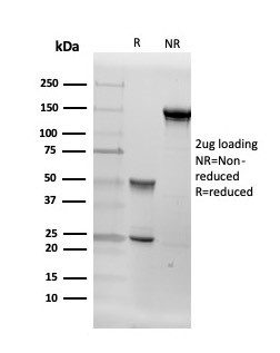 Aromatase/Cytochrome P450 (CYP19A1) Antibody in SDS-PAGE (SDS-PAGE)