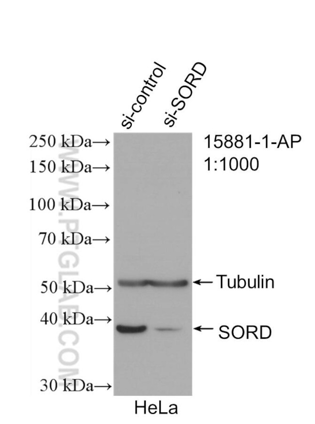 Sorbitol dehydrogenase Antibody in Western Blot (WB)