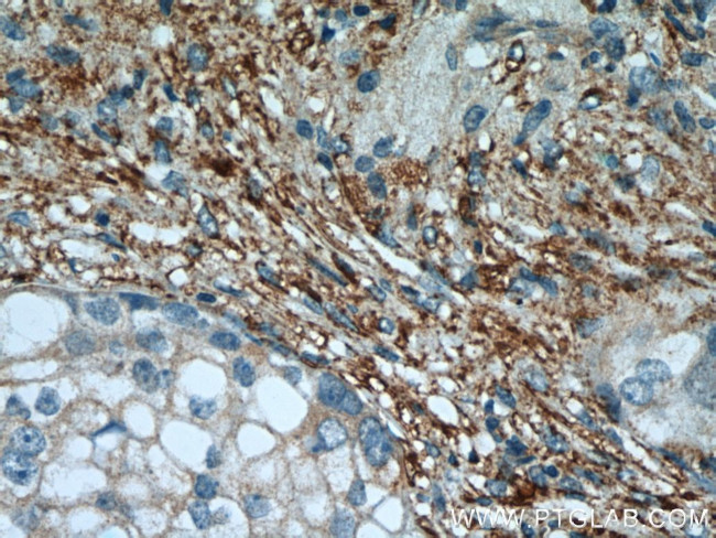 PPP2R1A Antibody in Immunohistochemistry (Paraffin) (IHC (P))