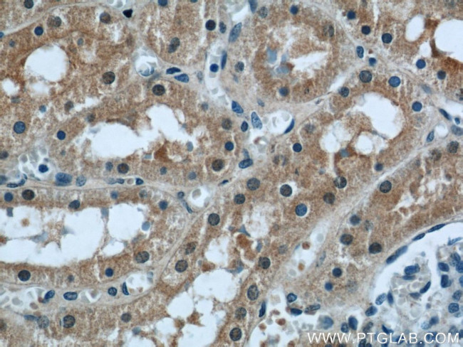 PPP2R1A Antibody in Immunohistochemistry (Paraffin) (IHC (P))