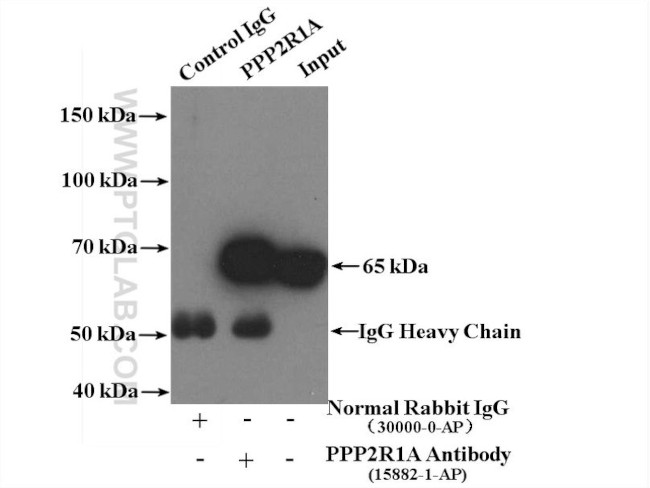 PPP2R1A Antibody in Immunoprecipitation (IP)