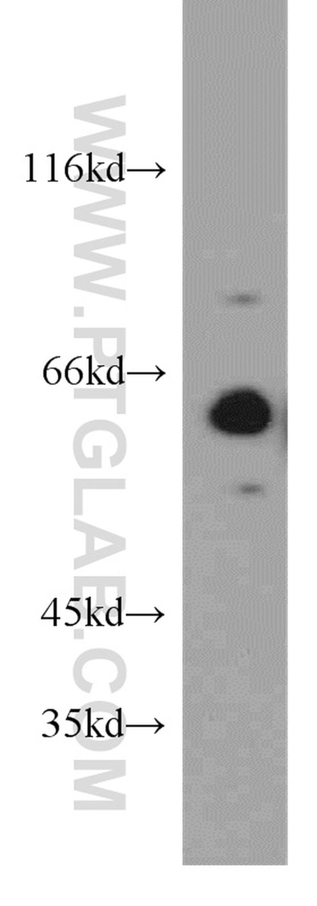 PPP2R1A Antibody in Western Blot (WB)