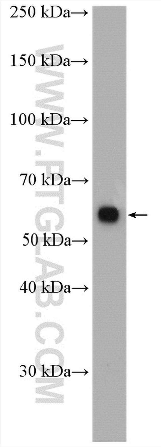 PPP2R1A Antibody in Western Blot (WB)