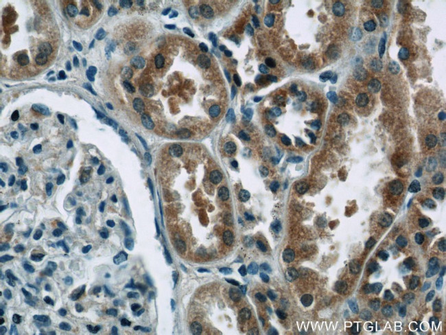 EIF1B Antibody in Immunohistochemistry (Paraffin) (IHC (P))