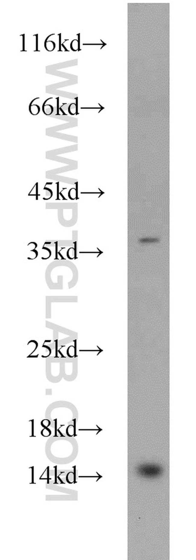 EIF1B Antibody in Western Blot (WB)