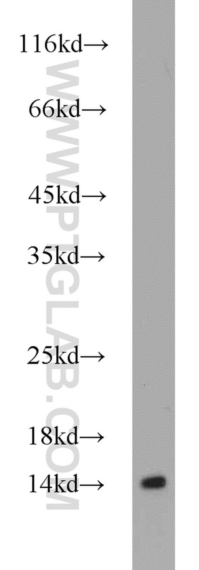 EIF1B Antibody in Western Blot (WB)