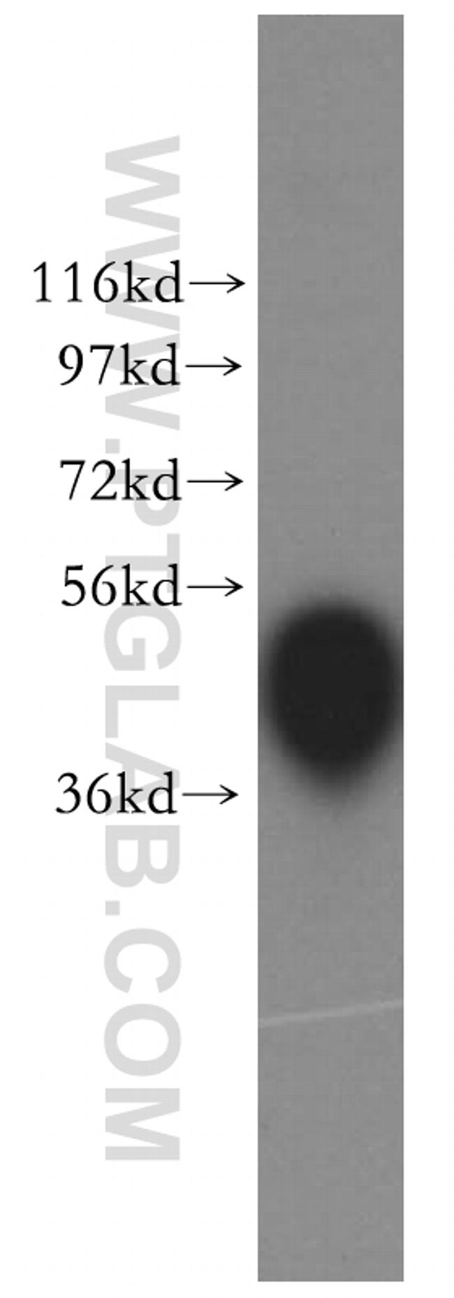 CKM/CKB Antibody in Western Blot (WB)