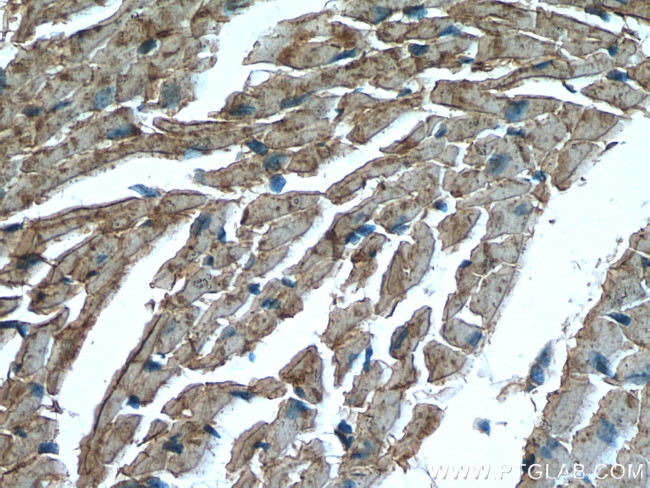 CKM/CKB Antibody in Immunohistochemistry (Paraffin) (IHC (P))