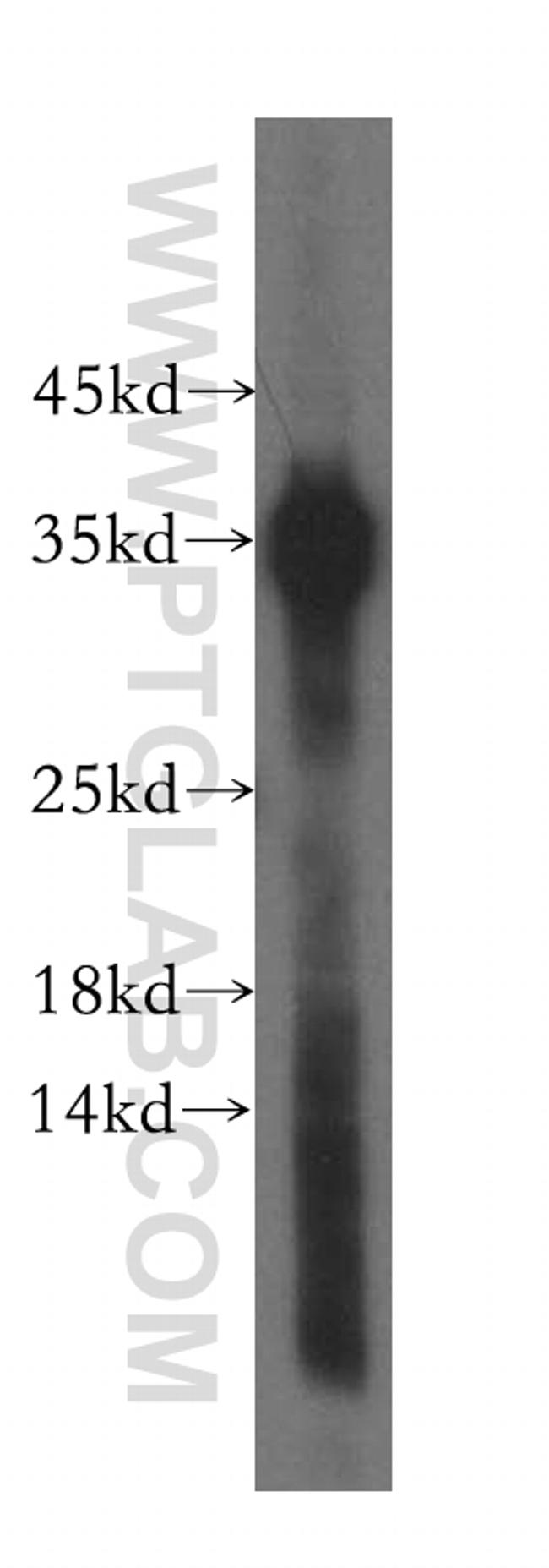 TNNT1 Antibody in Western Blot (WB)