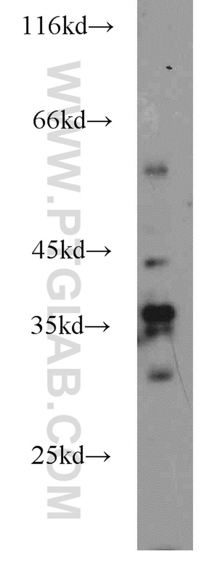 NECAP2 Antibody in Western Blot (WB)