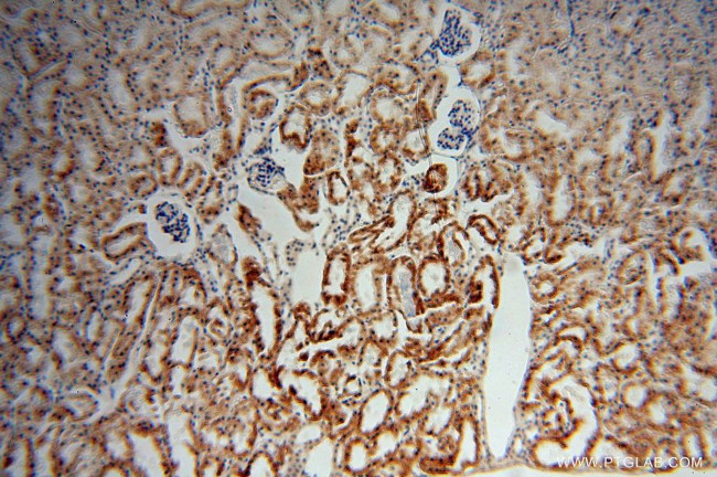 ACTO9 Antibody in Immunohistochemistry (Paraffin) (IHC (P))