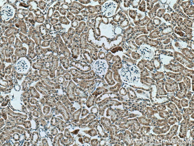 ACTO9 Antibody in Immunohistochemistry (Paraffin) (IHC (P))