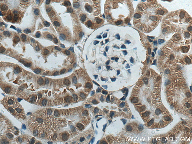 ACTO9 Antibody in Immunohistochemistry (Paraffin) (IHC (P))