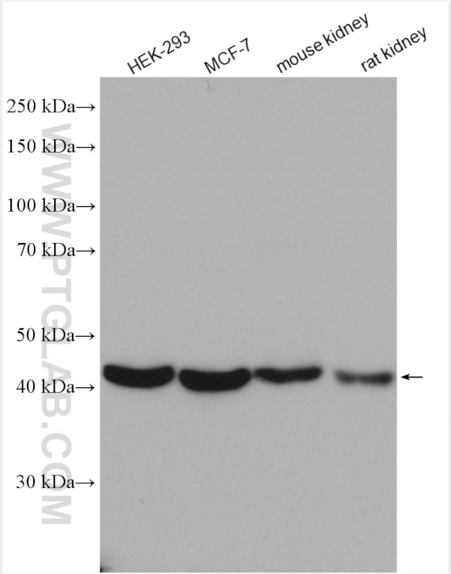 ACTO9 Antibody in Western Blot (WB)